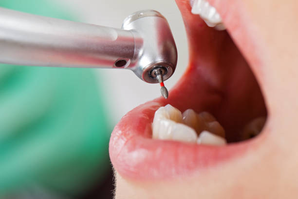 Best Weekend Emergency Dentist in Lake Holiday, VA